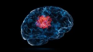 Dolore e cervello: idee sulla natura del dolore