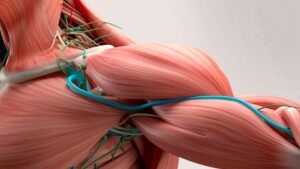 Thoracic Outlet Syndrome: quando l'entità diagnostica non è un'illusione clinica