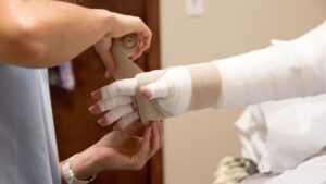 Linfedema in Fisioterapia