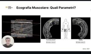 Anatomia ecografica: ginocchio e complesso degli hamstring