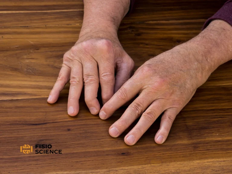 Artrite Psoriasica cover