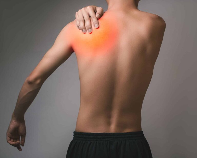 Sindrome di Parsonage-Turner