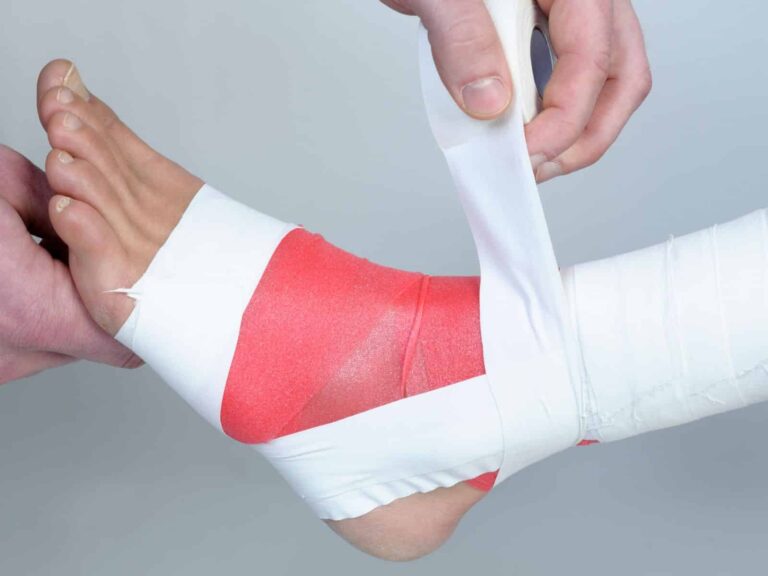 bendaggio funzionale