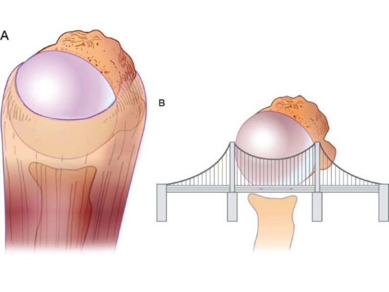 copertina rotator cable