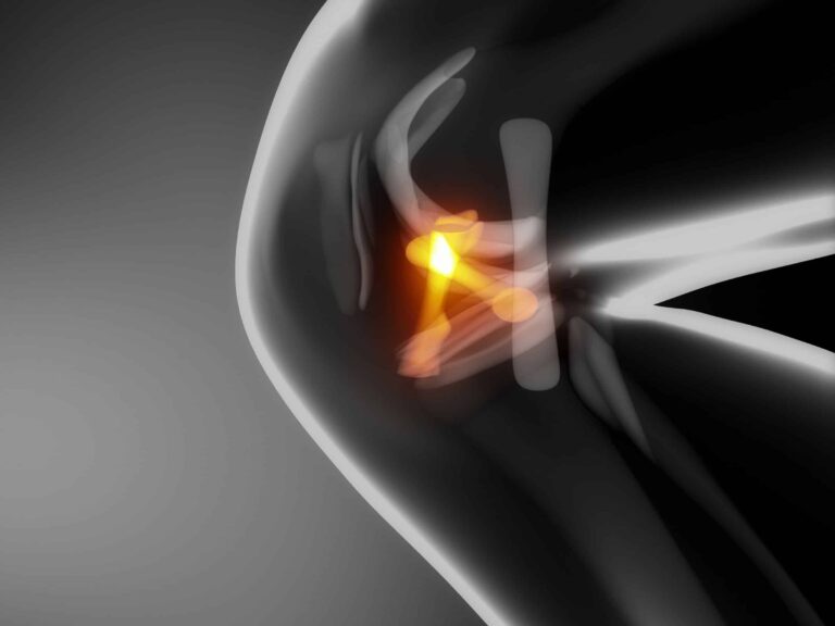 legamento crociato posteriore