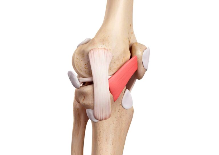 lesione legamento collaterale mediale