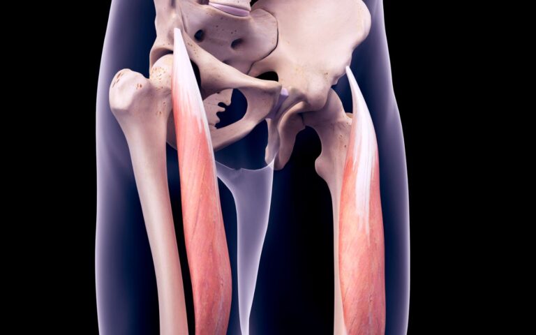 retto femorale lesione fisioscience