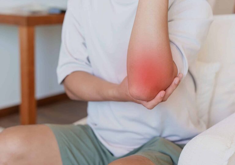 snapping elbow syndrome